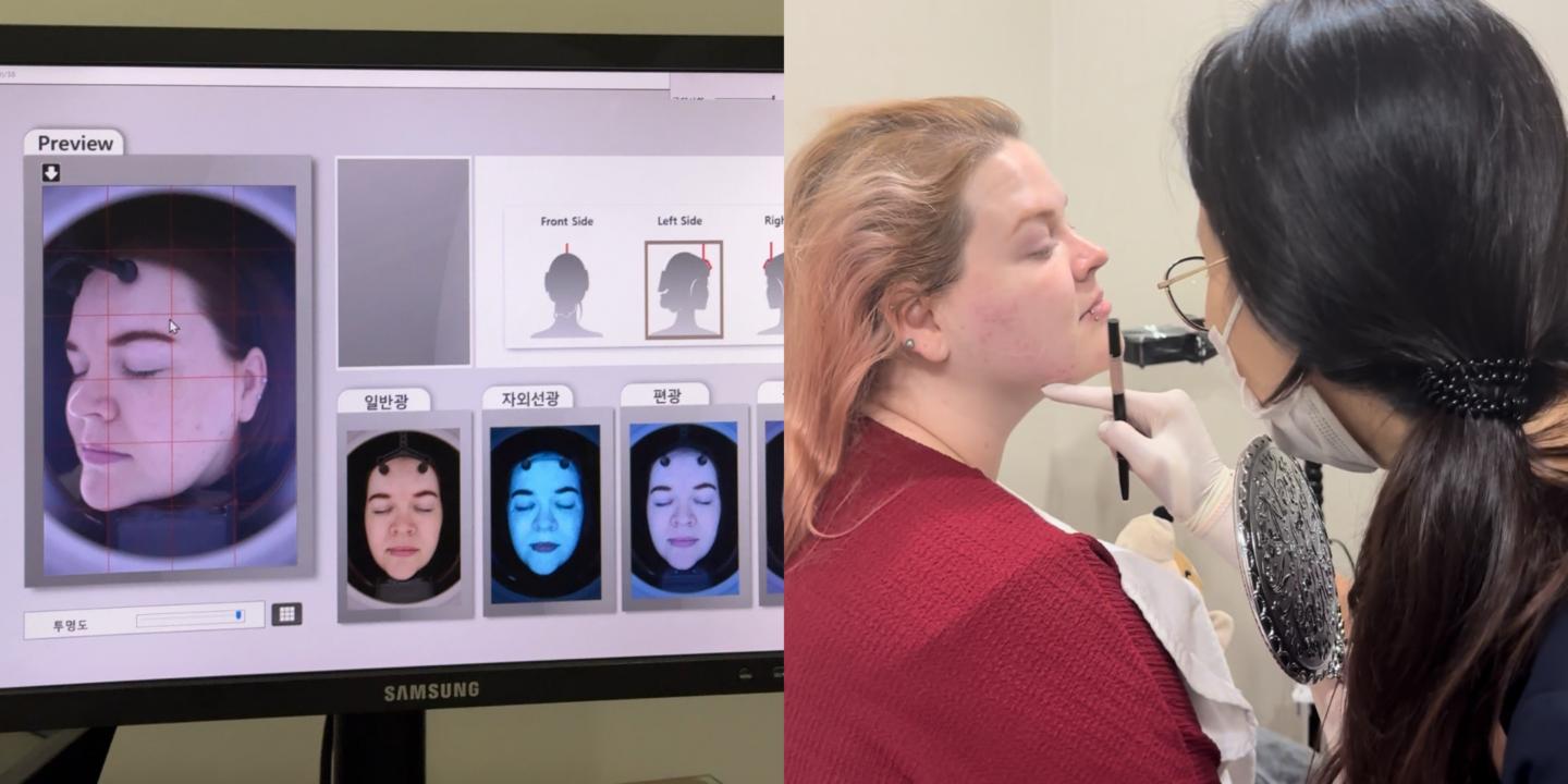 Digital skin-analysis imaging on a monitor beside a consultant examining an international visitor's skin